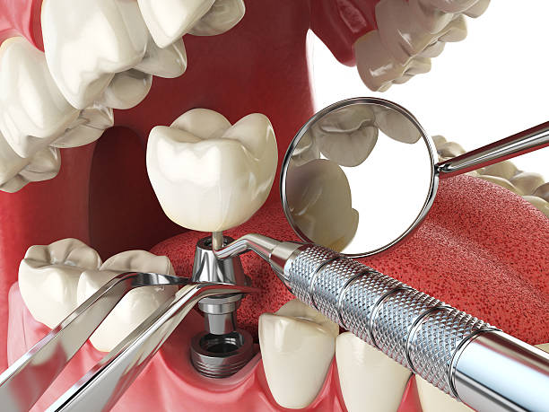 Best Cracked Tooth Emergency Dentist  in White Oak, MD