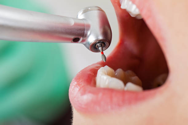Best Urgent Tooth Repair  in White Oak, MD